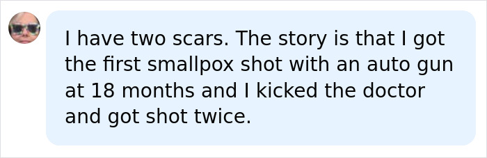 Lots Of People Have This Circular Scar, And Some Are Only Just Finding Out The Reason Behind It