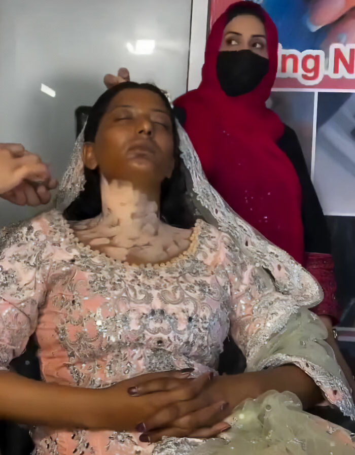 This Woman’s Dramatic Wedding Day Transformation Went Viral, But The Cultural Implications Have Sparked Heated Backlash This Woman’s Dramatic Wedding Day Transformation Went Viral, But The Cultural Implications Have Sparked Heated Backlash