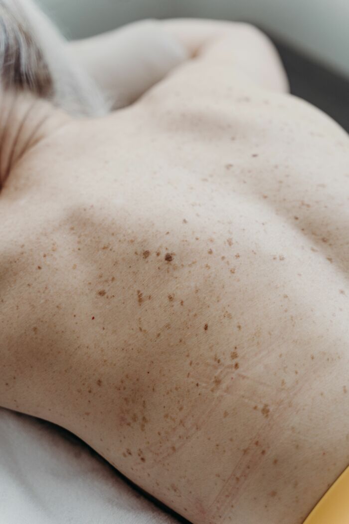 Hypochondriacs, Look Away: 61 Seemingly Innocent Health Symptoms That Terrify Doctors