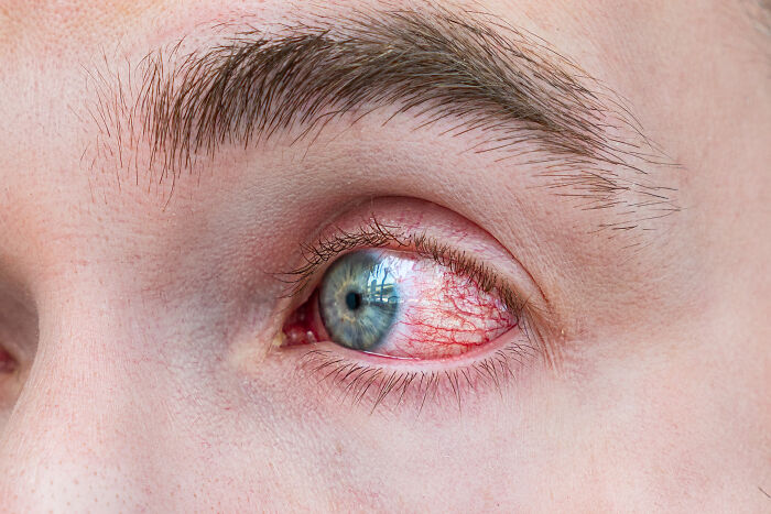 86 Times People Experienced Extreme Illness And Sickness And Lived To Tell The Tale