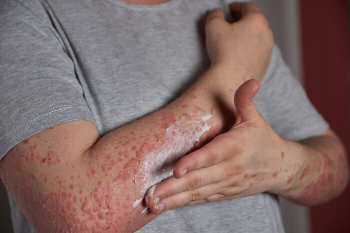 86 Times People Experienced Extreme Illness And Sickness And Lived To Tell The Tale