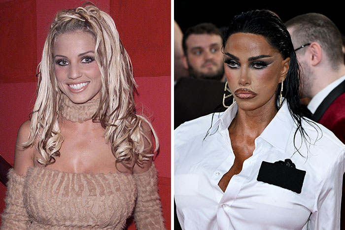 Katie Price Sparks Concern With Latest Appearance After Having Corrective Surgery Katie Price Sparks Concern With Latest Appearance After Having Corrective Surgery