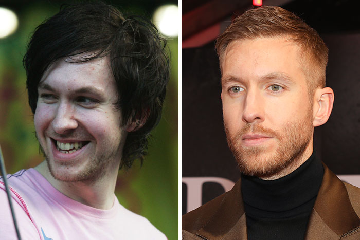 10 Famous People Who “Looksmaxxed” Throughout The Years, As Plastic Surgeons Hint At Procedures 10 Famous People Who “Looksmaxxed” Throughout The Years, As Plastic Surgeons Hint At Procedures