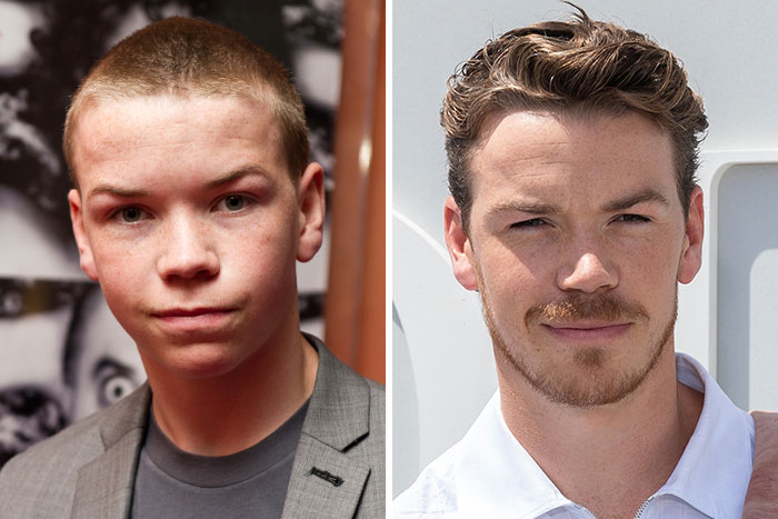 10 Famous People Who “Looksmaxxed” Throughout The Years, As Plastic Surgeons Hint At Procedures 10 Famous People Who “Looksmaxxed” Throughout The Years, As Plastic Surgeons Hint At Procedures