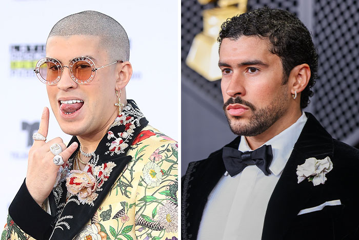 10 Famous People Who “Looksmaxxed” Throughout The Years, As Plastic Surgeons Hint At Procedures 10 Famous People Who “Looksmaxxed” Throughout The Years, As Plastic Surgeons Hint At Procedures