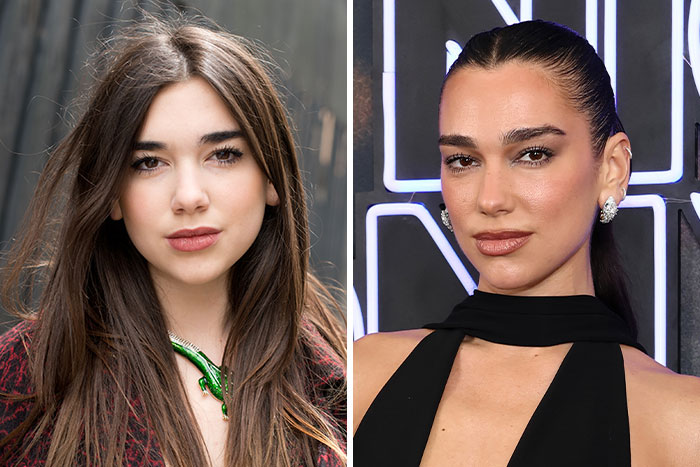 10 Famous People Who “Looksmaxxed” Throughout The Years, As Plastic Surgeons Hint At Procedures 10 Famous People Who “Looksmaxxed” Throughout The Years, As Plastic Surgeons Hint At Procedures
