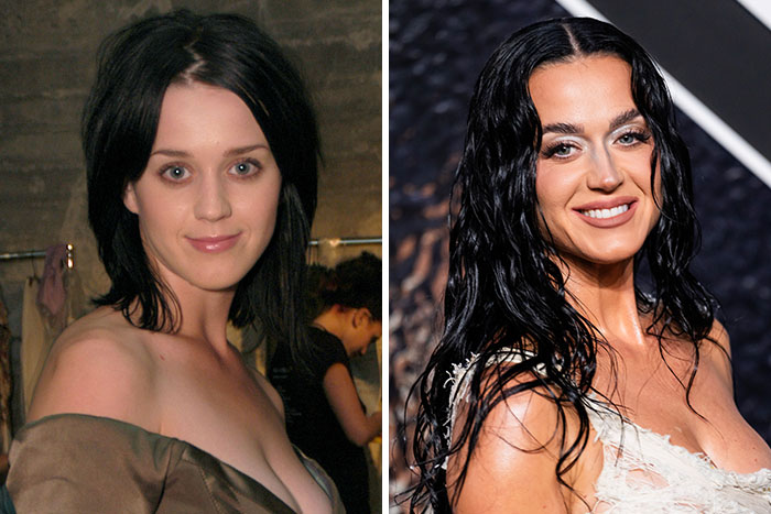 10 Famous People Who “Looksmaxxed” Throughout The Years, As Plastic Surgeons Hint At Procedures 10 Famous People Who “Looksmaxxed” Throughout The Years, As Plastic Surgeons Hint At Procedures
