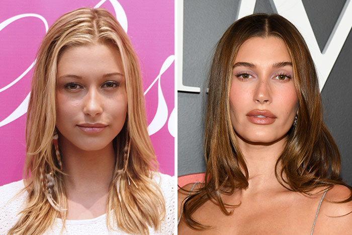 10 Famous People Who “Looksmaxxed” Throughout The Years, As Plastic Surgeons Hint At Procedures 10 Famous People Who “Looksmaxxed” Throughout The Years, As Plastic Surgeons Hint At Procedures