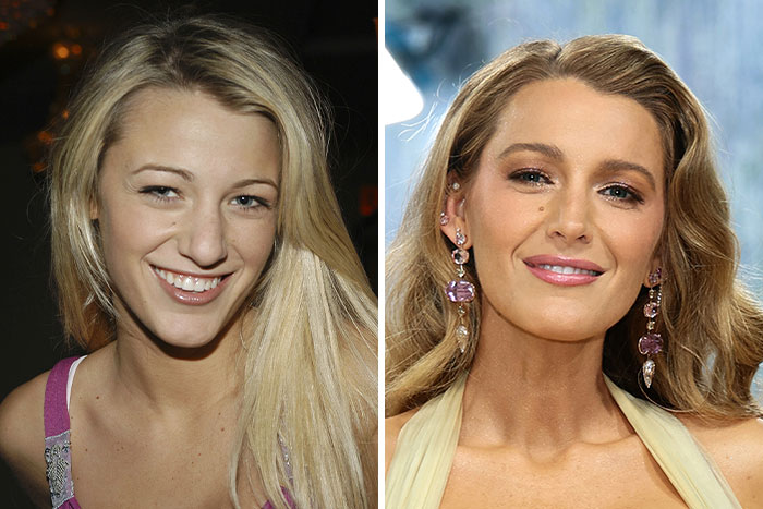 10 Famous People Who “Looksmaxxed” Throughout The Years, As Plastic Surgeons Hint At Procedures 10 Famous People Who “Looksmaxxed” Throughout The Years, As Plastic Surgeons Hint At Procedures