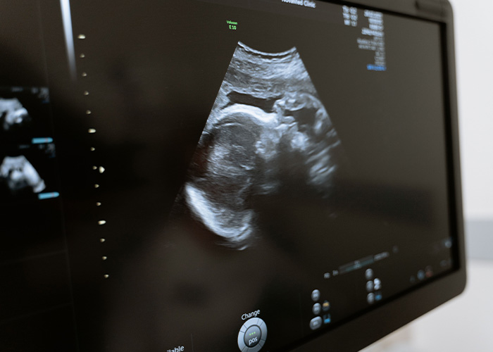 Surrogate Who Refused To End The Pregnancy Slammed By Child’s Biological Parents Over Supreme Court Bid