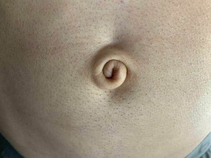 &ldquo;40 Years Of Hiding These&rdquo;: 85 Rare And Unexpected Body Quirks That Left People Fascinated