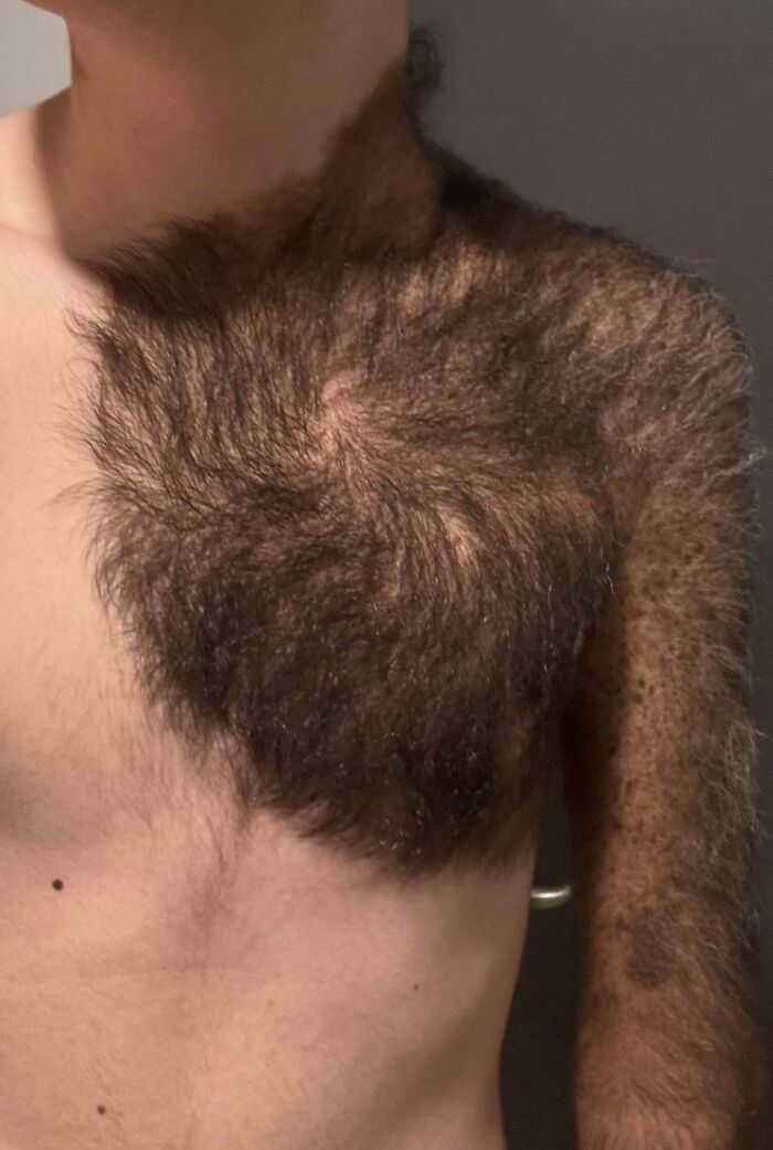 &ldquo;40 Years Of Hiding These&rdquo;: 85 Rare And Unexpected Body Quirks That Left People Fascinated