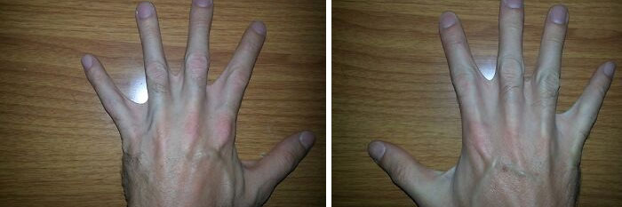 &ldquo;40 Years Of Hiding These&rdquo;: 85 Rare And Unexpected Body Quirks That Left People Fascinated