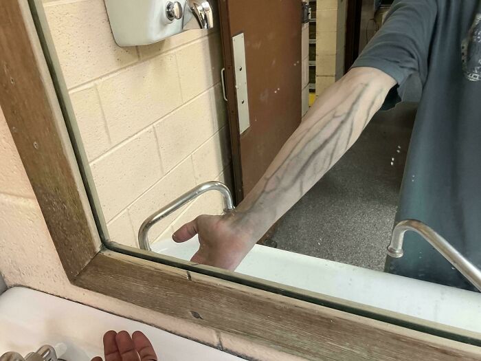 &ldquo;40 Years Of Hiding These&rdquo;: 85 Rare And Unexpected Body Quirks That Left People Fascinated