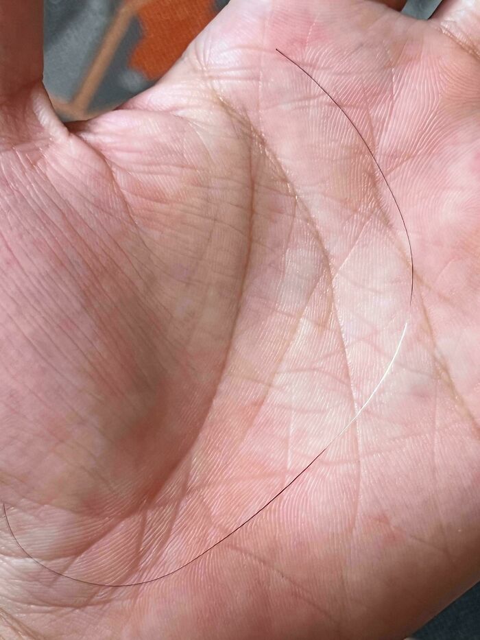 &ldquo;40 Years Of Hiding These&rdquo;: 85 Rare And Unexpected Body Quirks That Left People Fascinated