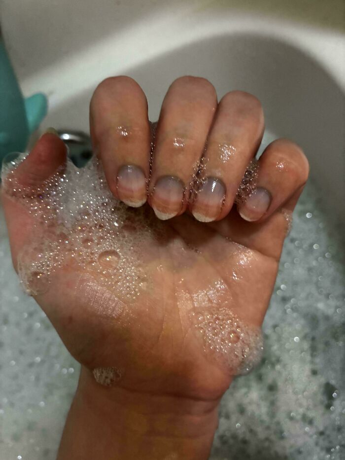 &ldquo;40 Years Of Hiding These&rdquo;: 85 Rare And Unexpected Body Quirks That Left People Fascinated