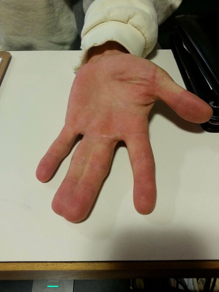 &ldquo;40 Years Of Hiding These&rdquo;: 85 Rare And Unexpected Body Quirks That Left People Fascinated