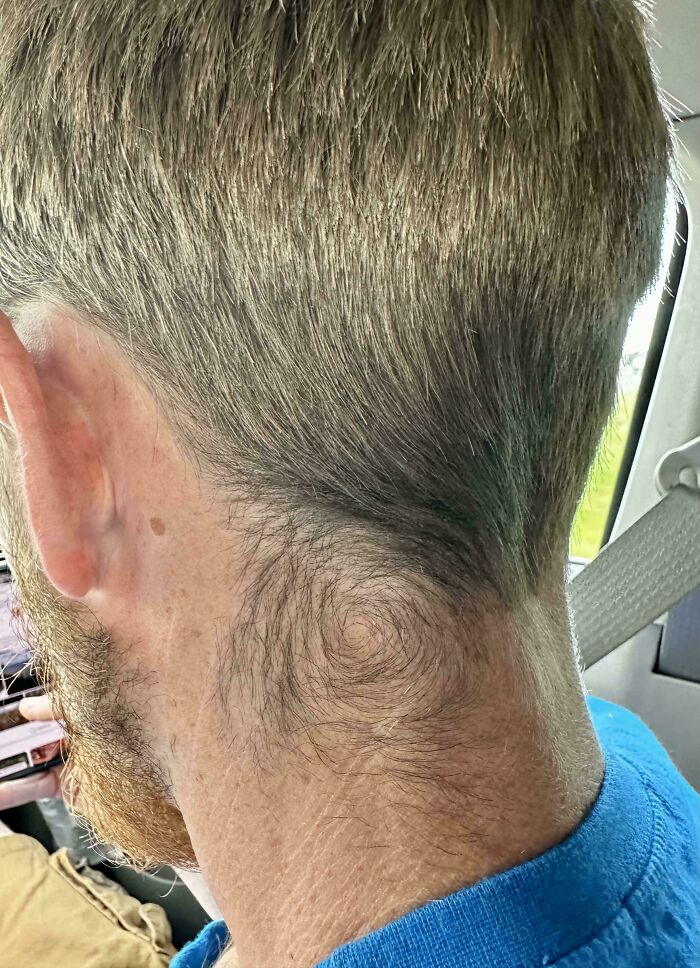 &ldquo;40 Years Of Hiding These&rdquo;: 85 Rare And Unexpected Body Quirks That Left People Fascinated