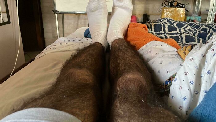 &ldquo;40 Years Of Hiding These&rdquo;: 85 Rare And Unexpected Body Quirks That Left People Fascinated