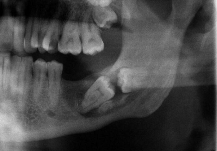 &ldquo;40 Years Of Hiding These&rdquo;: 85 Rare And Unexpected Body Quirks That Left People Fascinated