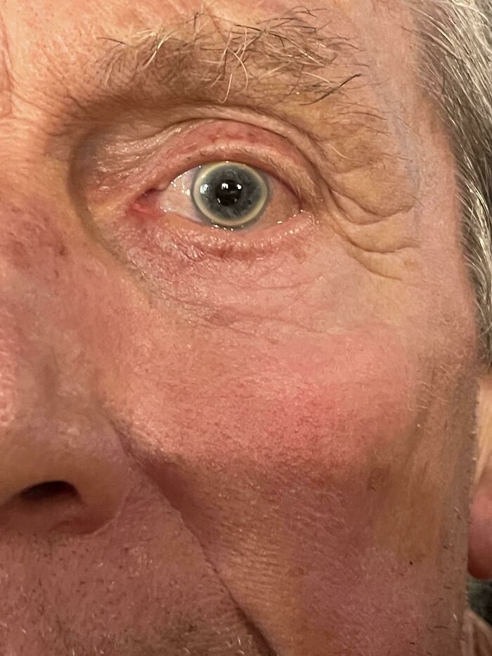 &ldquo;40 Years Of Hiding These&rdquo;: 85 Rare And Unexpected Body Quirks That Left People Fascinated