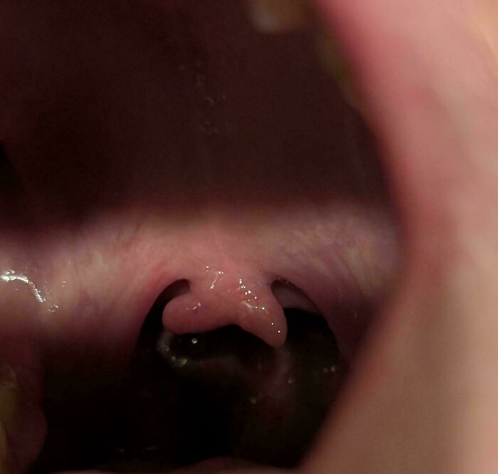 &ldquo;40 Years Of Hiding These&rdquo;: 85 Rare And Unexpected Body Quirks That Left People Fascinated