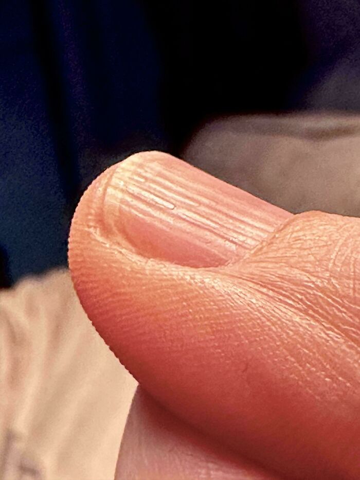 &ldquo;40 Years Of Hiding These&rdquo;: 85 Rare And Unexpected Body Quirks That Left People Fascinated