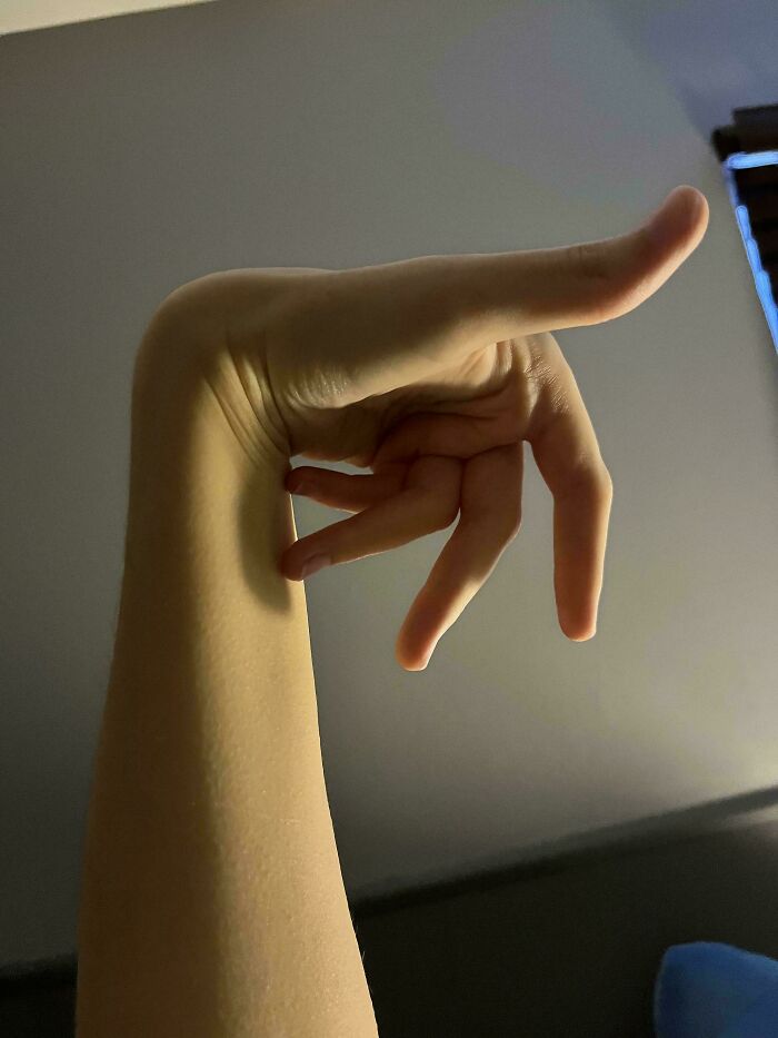 &ldquo;40 Years Of Hiding These&rdquo;: 85 Rare And Unexpected Body Quirks That Left People Fascinated