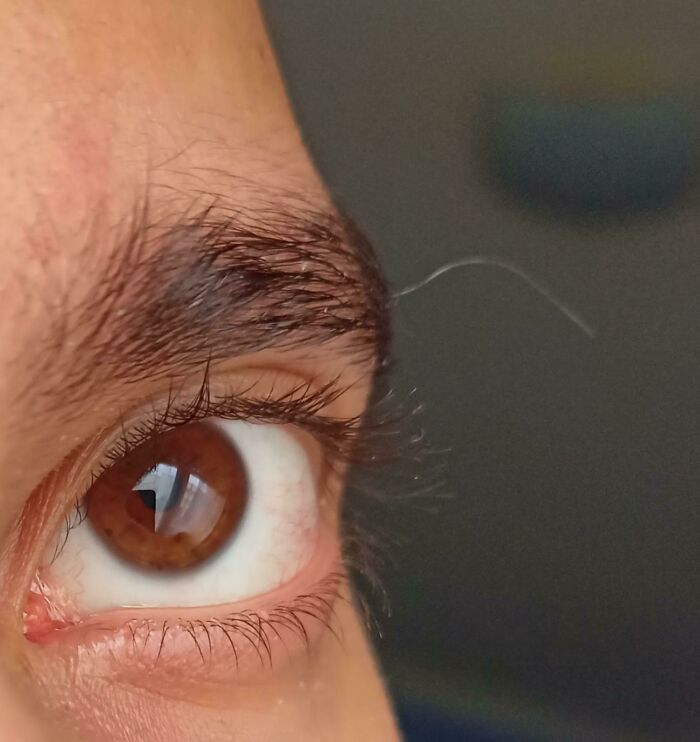 &ldquo;40 Years Of Hiding These&rdquo;: 85 Rare And Unexpected Body Quirks That Left People Fascinated