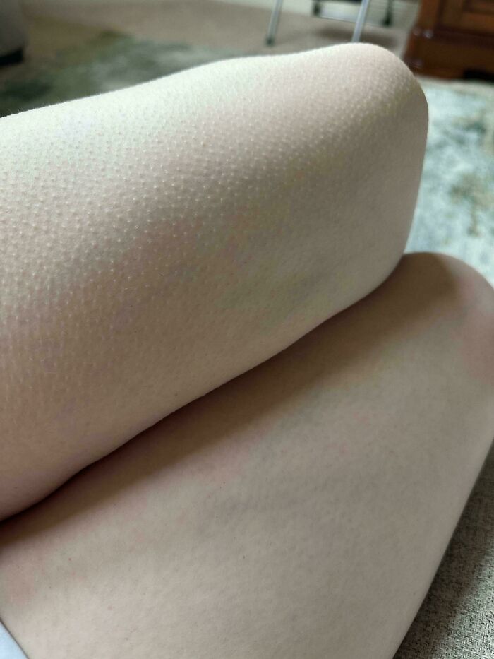 &ldquo;40 Years Of Hiding These&rdquo;: 85 Rare And Unexpected Body Quirks That Left People Fascinated