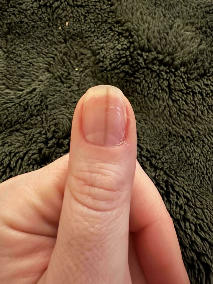 &ldquo;40 Years Of Hiding These&rdquo;: 85 Rare And Unexpected Body Quirks That Left People Fascinated