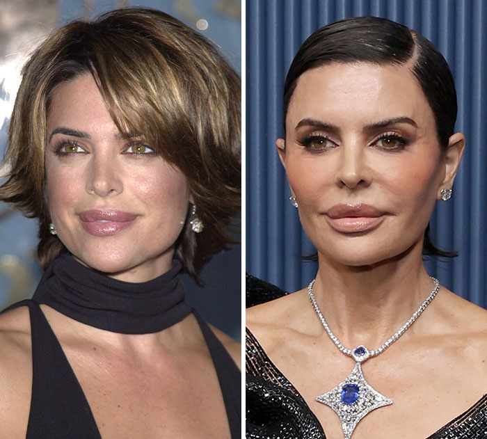 The 15 Biggest Transformations As Plastic Surgery And Weight Loss Dominate The 2026 Emmys