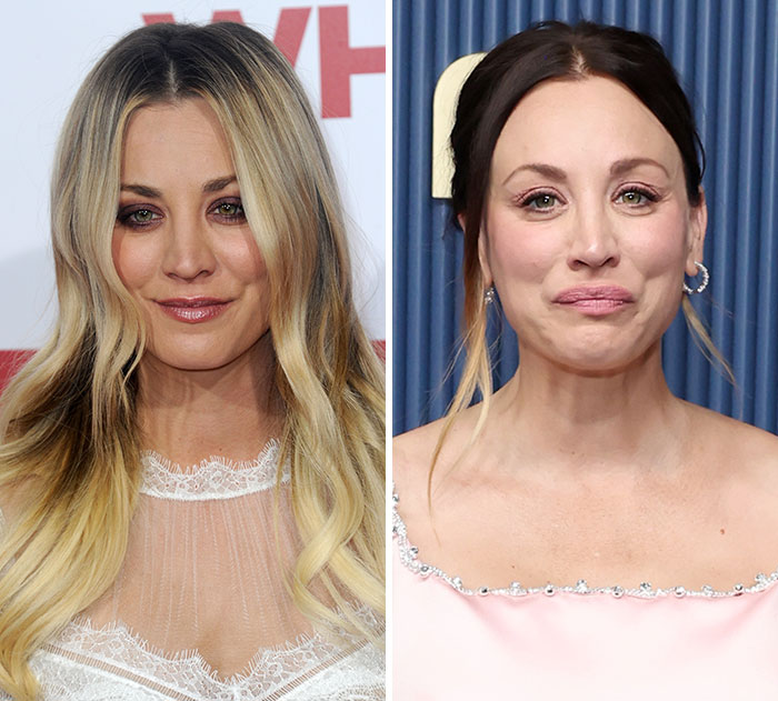 The 15 Biggest Transformations As Plastic Surgery And Weight Loss Dominate The 2026 Emmys