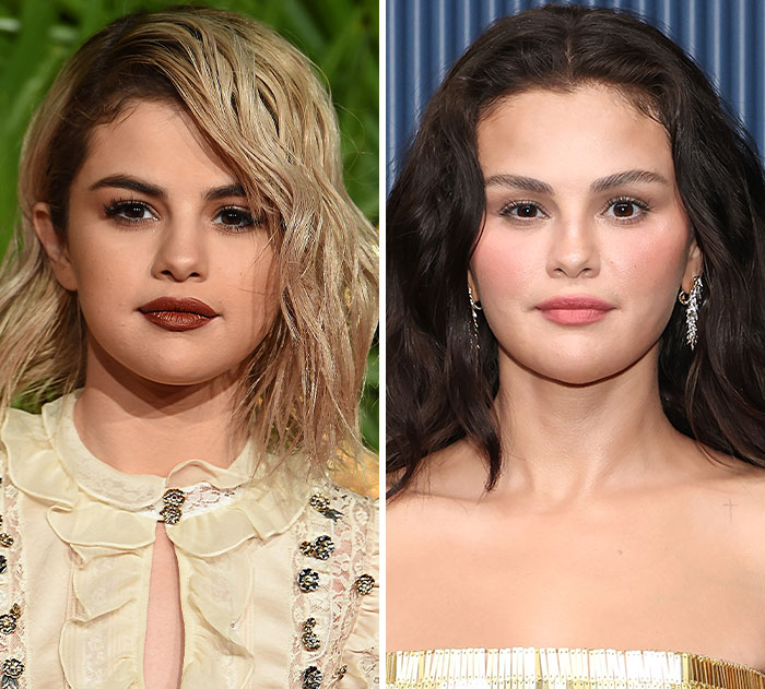 The 15 Biggest Transformations As Plastic Surgery And Weight Loss Dominate The 2026 Emmys