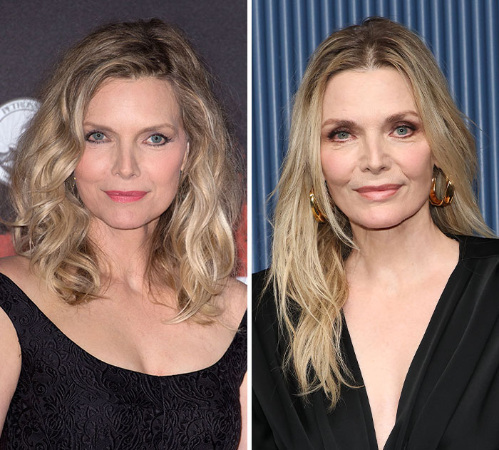 The 15 Biggest Transformations As Plastic Surgery And Weight Loss Dominate The 2026 Emmys