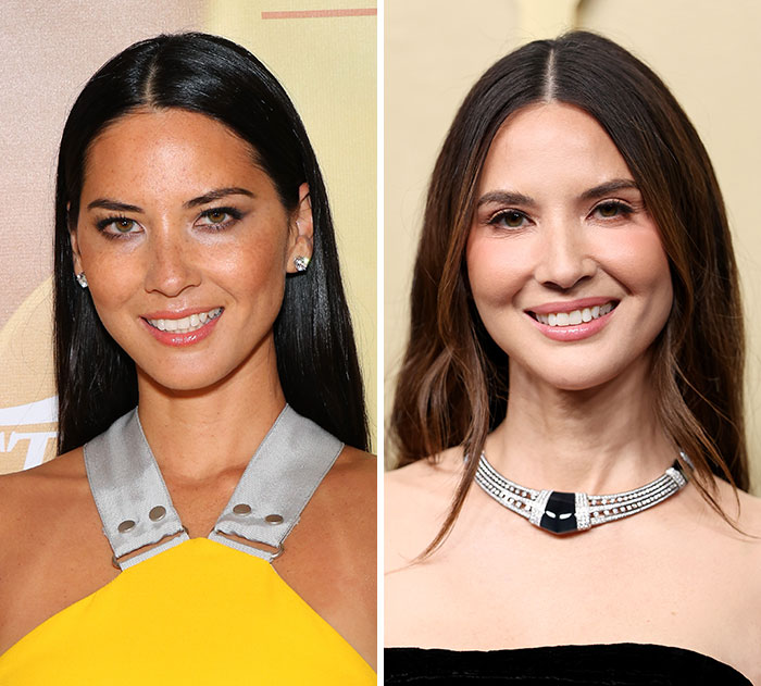 The 15 Biggest Transformations As Plastic Surgery And Weight Loss Dominate The 2026 Emmys