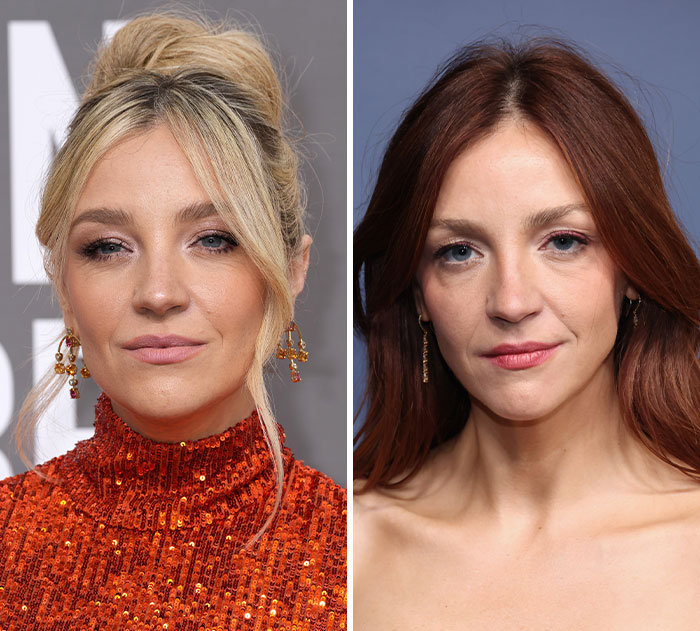 The 15 Biggest Transformations As Plastic Surgery And Weight Loss Dominate The 2026 Emmys