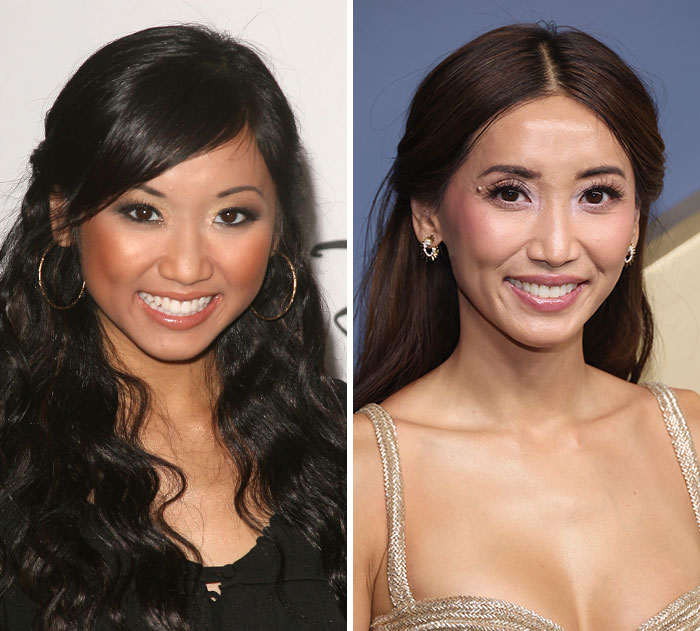 The 15 Biggest Transformations As Plastic Surgery And Weight Loss Dominate The 2026 Emmys