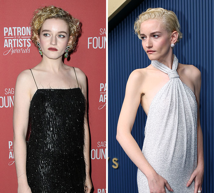 The 15 Biggest Transformations As Plastic Surgery And Weight Loss Dominate The 2026 Emmys