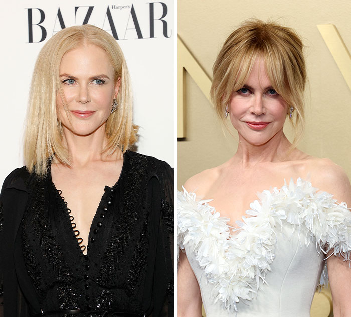 The 15 Biggest Transformations As Plastic Surgery And Weight Loss Dominate The 2026 Emmys