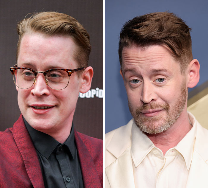 The 15 Biggest Transformations As Plastic Surgery And Weight Loss Dominate The 2026 Emmys