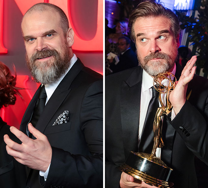 The 15 Biggest Transformations As Plastic Surgery And Weight Loss Dominate The 2026 Emmys