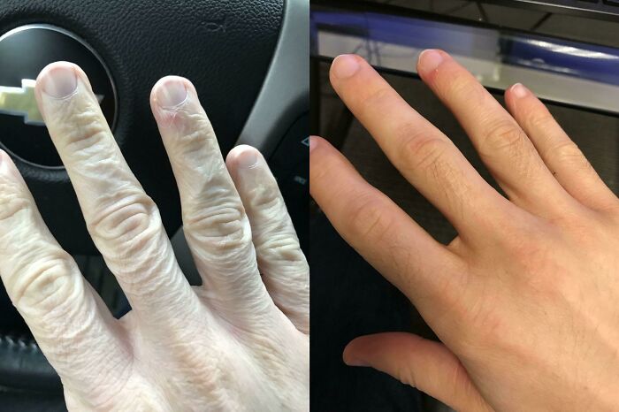 66 Before And After Photos That Show Surprising, Fascinating And Inspiring Transformations