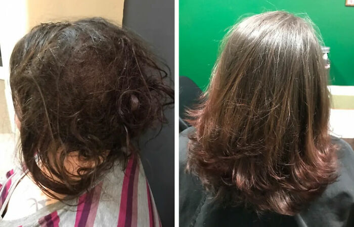 66 Before And After Photos That Show Surprising, Fascinating And Inspiring Transformations