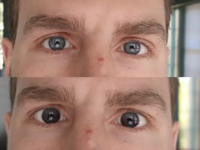 66 Before And After Photos That Show Surprising, Fascinating And Inspiring Transformations