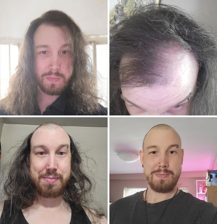 66 Before And After Photos That Show Surprising, Fascinating And Inspiring Transformations