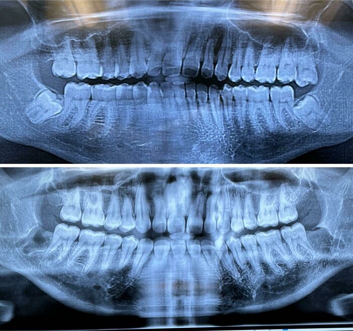66 Before And After Photos That Show Surprising, Fascinating And Inspiring Transformations