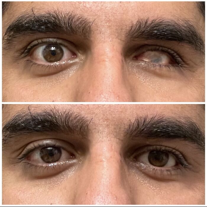 66 Before And After Photos That Show Surprising, Fascinating And Inspiring Transformations