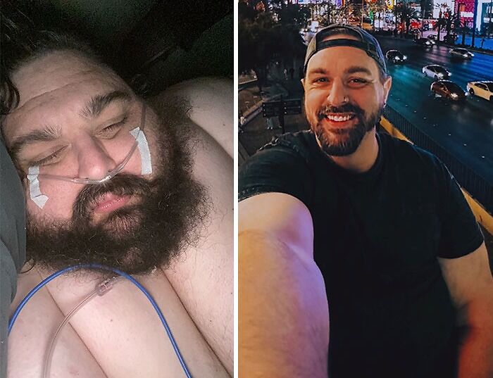 74 Wild Glow-Ups That Turned People’s Self-Doubt Into Confidence 74 Wild Glow-Ups That Turned People’s Self-Doubt Into Confidence