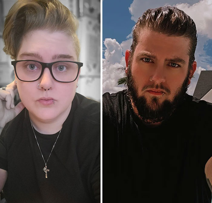 74 Wild Glow-Ups That Turned People’s Self-Doubt Into Confidence 74 Wild Glow-Ups That Turned People’s Self-Doubt Into Confidence